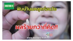 ฟันน้ำนมหลุด