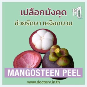 เหงือกบวม