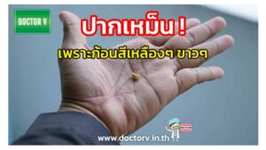 ปากเหม็น