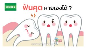 ฟันคุด