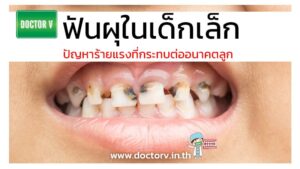 ฟันผุในเด็กเล็ก