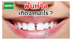 ฟันห่าง