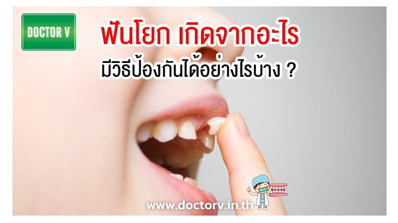 ฟันโยก