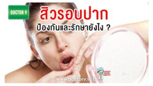 สิวรอบปาก