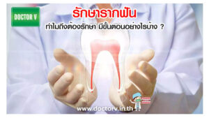 รักษารากฟัน