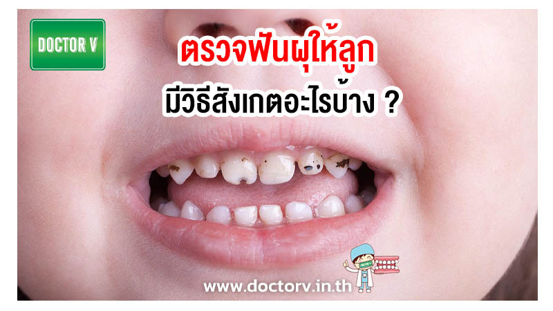 ตรวจฟันผุให้ลูก